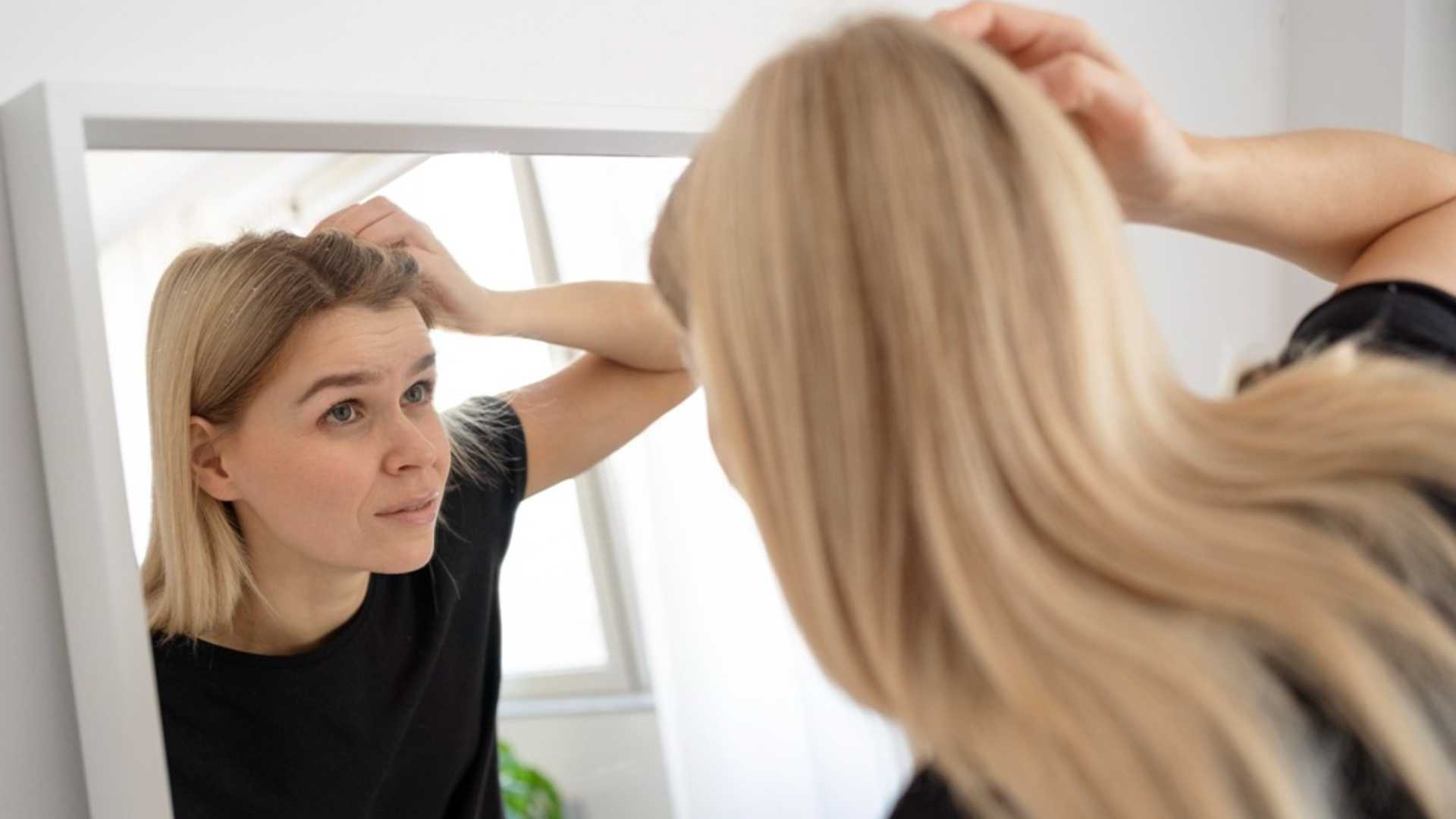 Quando il melanoma si nasconde tra i capelli